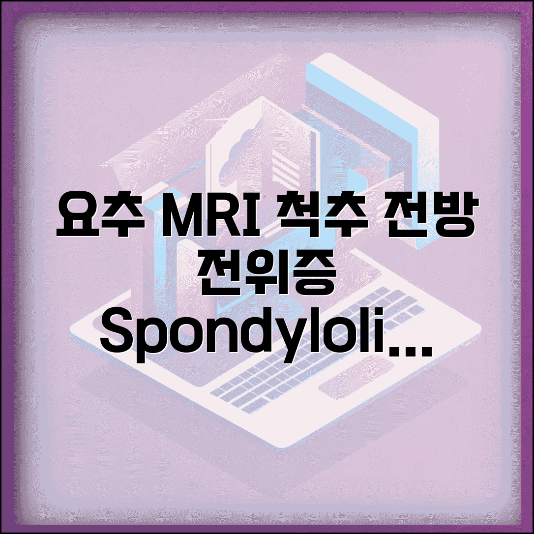 요추MRI 척추전방전위증 spondylolisthesis 등급 | 척추 전방 전위 1도 2도 3도 4도